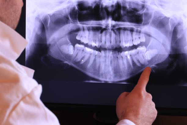 Emergency TMJ Treatment